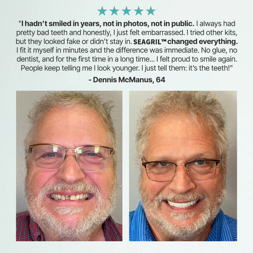 😁 Ends Today: 70% OFF! ⏰SEAGRIL® Medical Full Denture with Strong Suctiond🦷Obtain American Dental Association (ADA) Certification