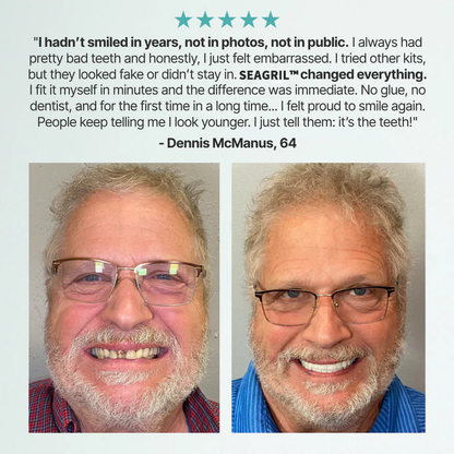 😁 Ends Today: 70% OFF! ⏰SEAGRIL® Medical Full Denture with Strong Suctiond🦷Obtain American Dental Association (ADA) Certification